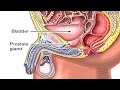 Enlarged Prostate Gland: Benign Prostatic Hyperplasia Animation -Symptoms and Treatment of BPH Video