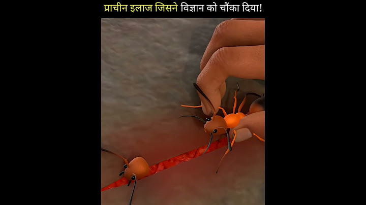 Using Ants to Stitch Wounds: An Ancient Healing Technique🐜🐜#shorts #shortvideo