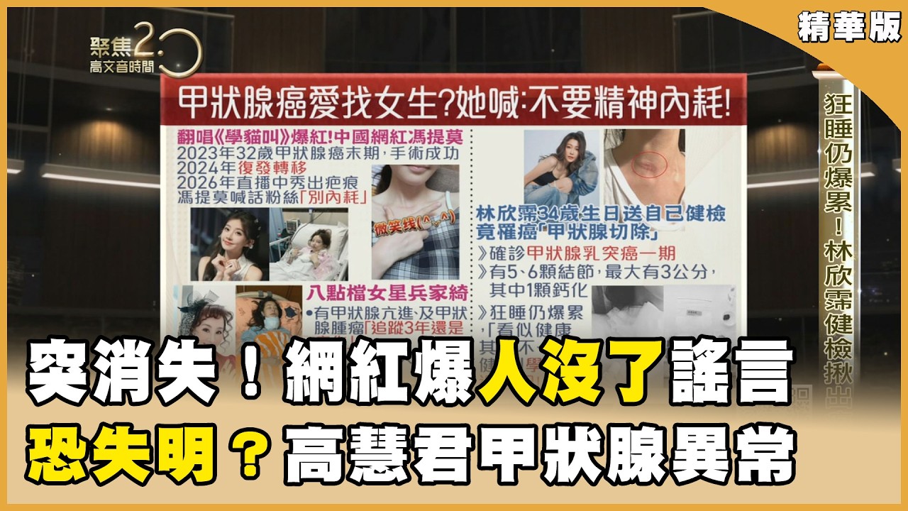 「溫柔」的癌症？中國網紅馮提莫割喉保命！甲狀腺風暴！高慧君嚴重斜視、重影恐失明？【聚焦2.0】第618集