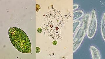 Microorganism moving methods - Flagella, Pseudopodia, and Cilia