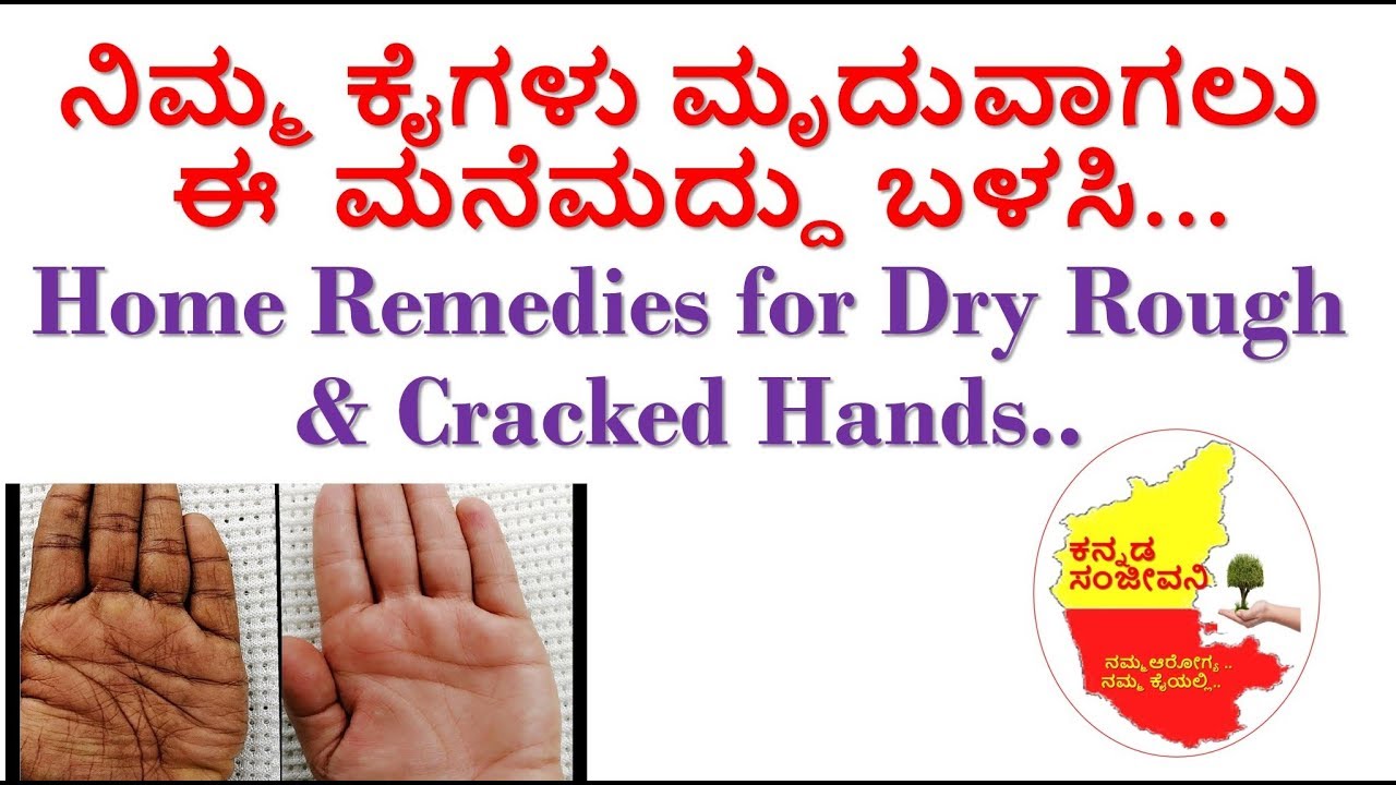 How to get Soft & Smooth Hands Kannada | Home remedies for Rough dry ...