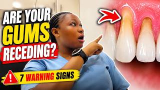 Are your gums receding Do this before its too late 🚨