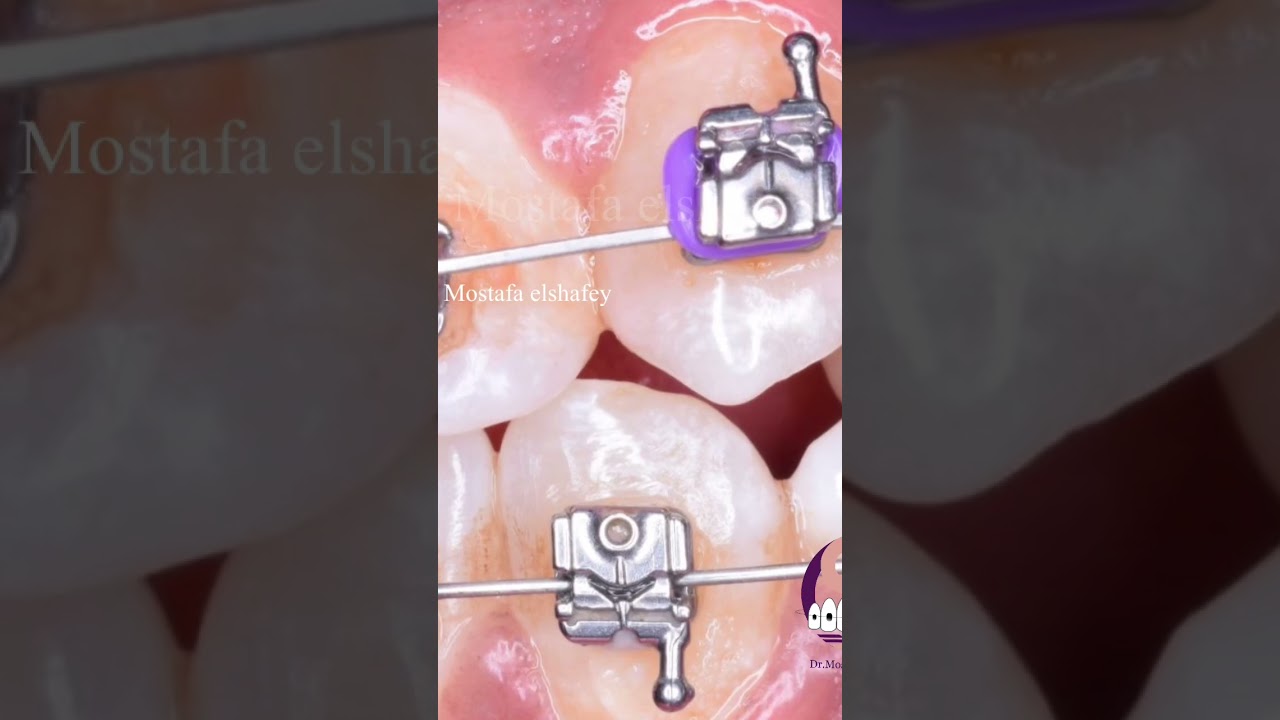 How to management of high canine