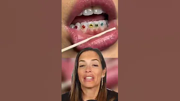 ¿Puedo pegarme gemas en los dientes?