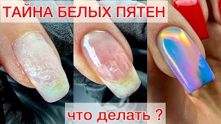 ТАЙНА БЕЛЫХ ПЯТЕН НА НОГТЕ #nails #ногти #гельлак #manicure