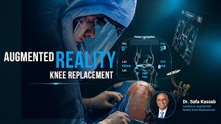 Dr. kassab on CBS Detroit | Augmented Reality Knee Replacement | Dr. Kassab | OSOC