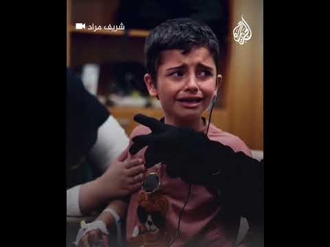 رد فعل طفل سوري يتمكن من السماع لأول مرة في حياته بعد زراعة قوقعة
