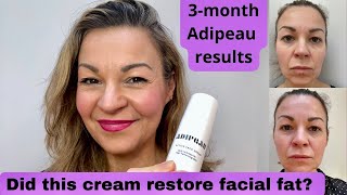 Adipeau facial fat renewal cream | 3month review with before and afters