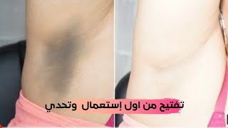 لن تصدقي من جمال هذه الوصفه تبيض الاماكن الحساسه في ثوانيWhitening sensitive places in seconds