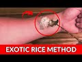 10 Second Rice Trick [[[WATCH NOW]]] Exotic Rice Method for Weight Loss