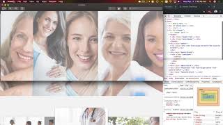 Homepage / Page Types / Repeaters - Building a Medical Group Website on PyroCMS v3.7-dev