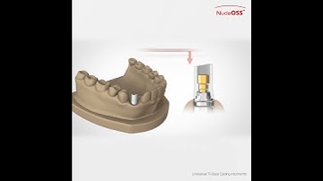NucleOSS | Universal Ti-base Casting Abutments