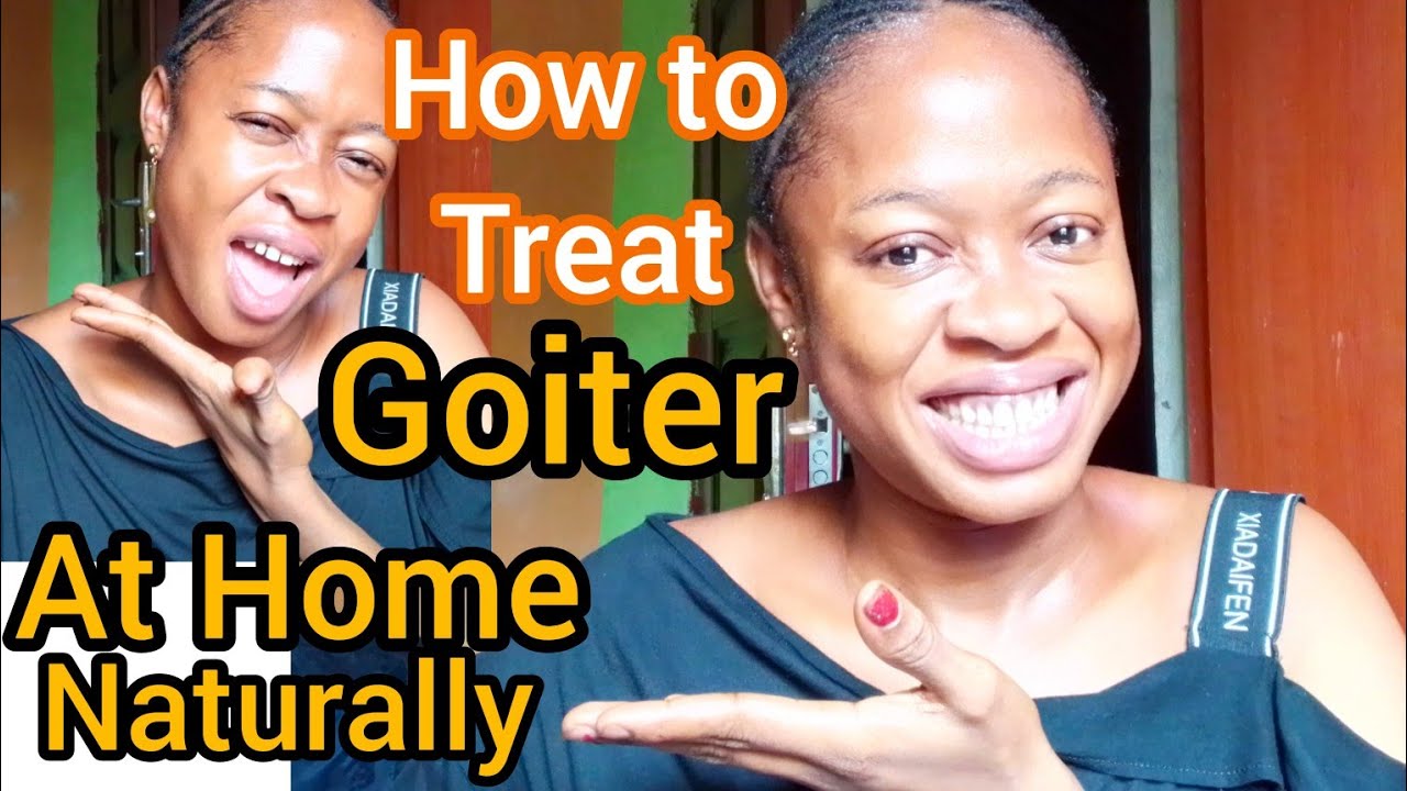 SHRINK GOITER|THYROID NODULES  AT HOME|BEST NATURAL REMEDY FOR GOITER