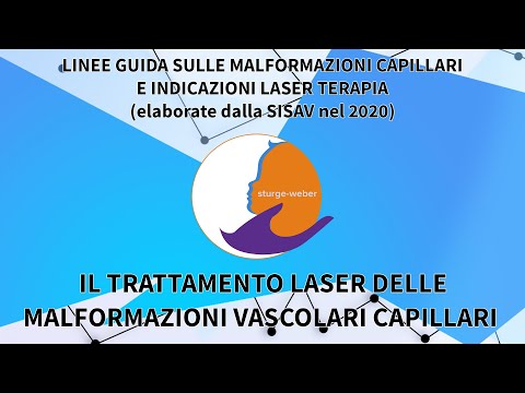 Il trattamento laser delle malformazioni vascolari capillari