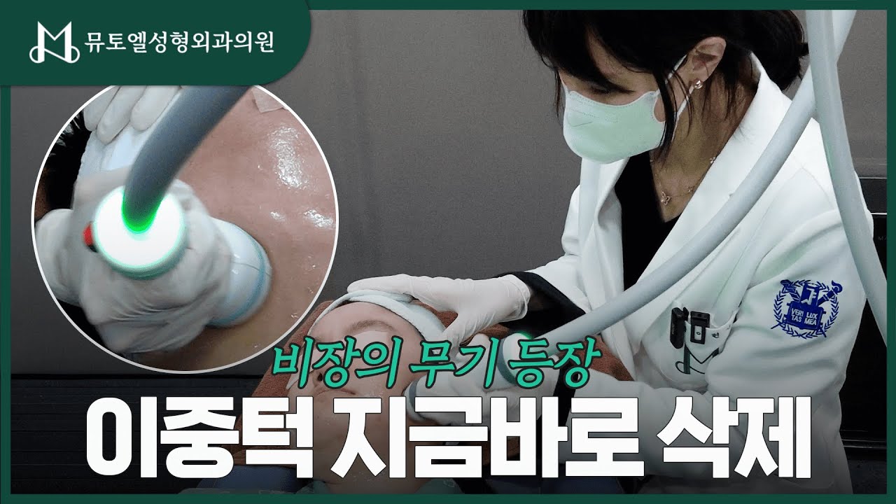 나의 턱선을 찾아주는 마법의 리프팅, 온다(Onda)리프팅 찐 후기🌟 #성형외과 #성형외과의사 #온다리프팅 #후기 #리프팅효과 #턱살 #리프팅시술 #이중턱 #피부관리 #피부시술