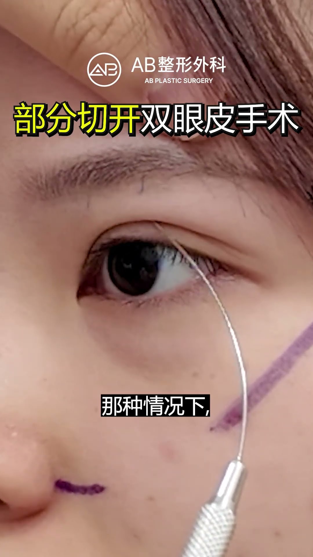 她為了更有神的眼睛來諮詢👁️ #shorts