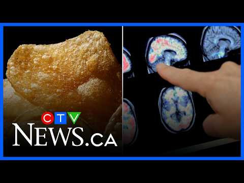 Enjoy eating chips and fast food? New study sheds light on how this could increase dementia risks