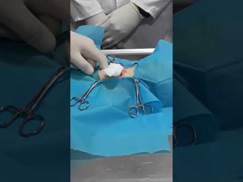 Vidéo: La stérilisation de votre chienne: FAQ sur la procédure chirurgicale