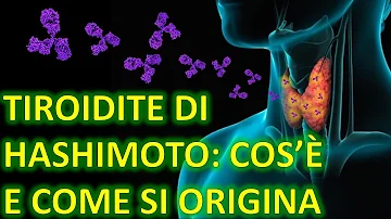 Cosa posso mangiare in caso di ipotiroidismo?