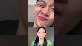 Never Pop Pimples Here The Triangle of Death Explain