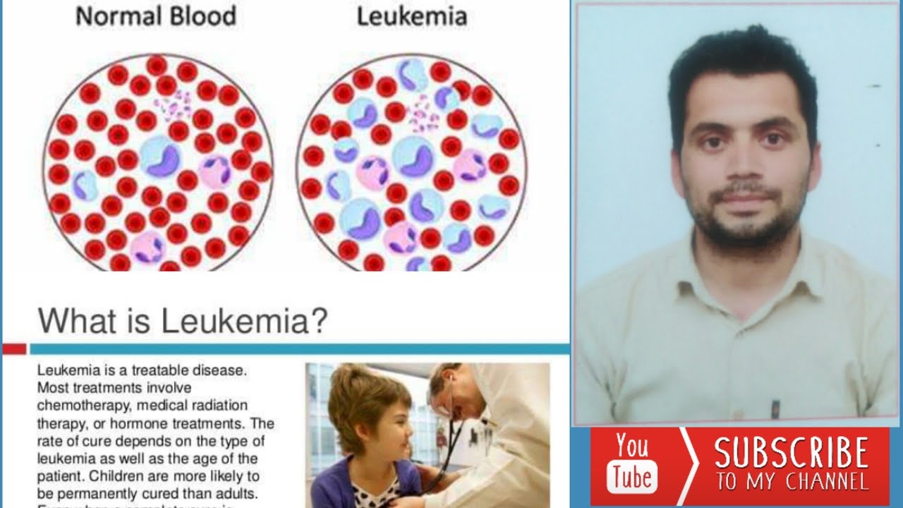 Leukemia Blood Cancer Causes Symptoms And Treatment Youtube