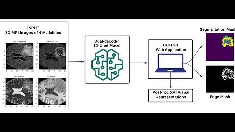2024  Brain Tumour Segmentation and Edge Detection Using Self Supervised Learning