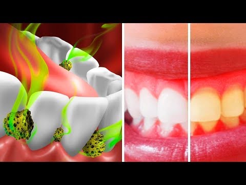 20 TRICKS TO TAKE CARE OF YOUR TEETH AND MOUTH