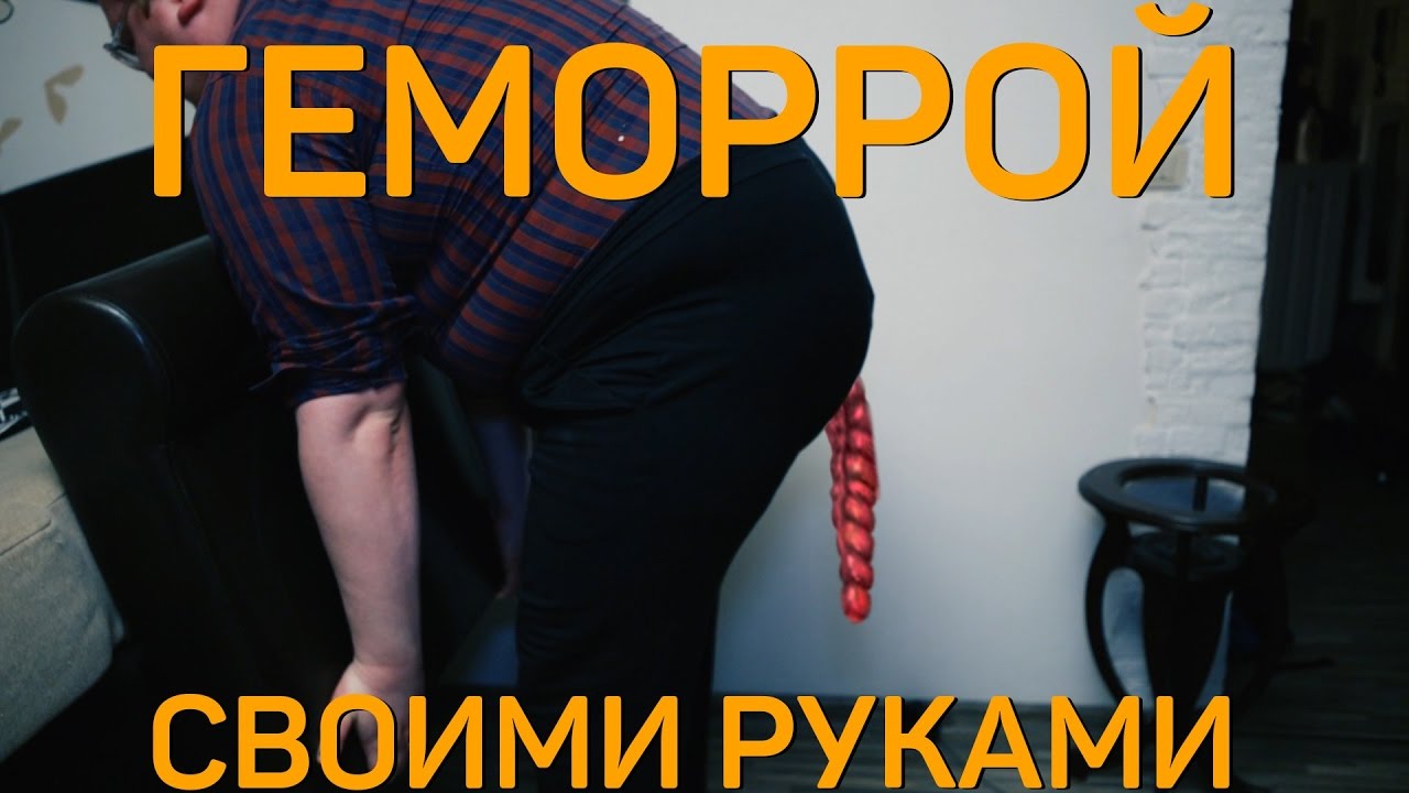 Своими Руками - ГЕМОРРОЙ camera iphone 8 plus apk