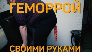 Своими Руками - ГЕМОРРОЙ