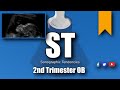 2nd trimester ob scan