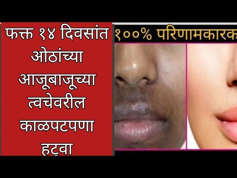 ओठांच्या आजूबाजूचा काळपटपणा कसा घालवावा|hyperpigmentation treatment|@Priya Makeup आणि beauty