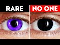 Why Can&#39;t You Have Black Eyes + Other Body Facts