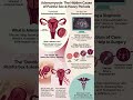 Adenomyosis: Why Painful Sex & Heavy Periods Happen Together | Double Hit Explained