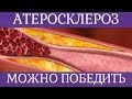 ❤ Как победить атеросклероз