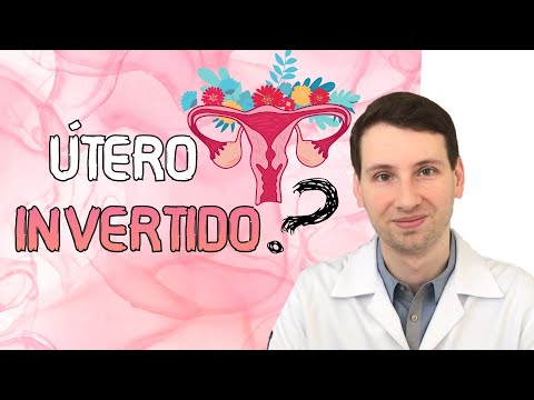 Vídeo: Quando o útero está inclinado para trás?