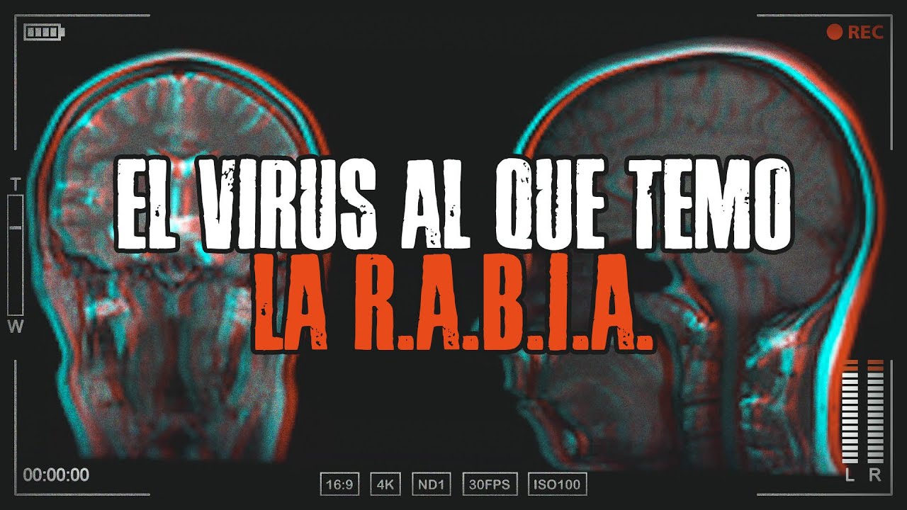 R A B I