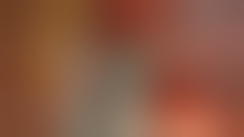 Uniportal RATS Left Upper Trisegmentectomy (S1-S3) with DaVinci Xi: Initial Experience