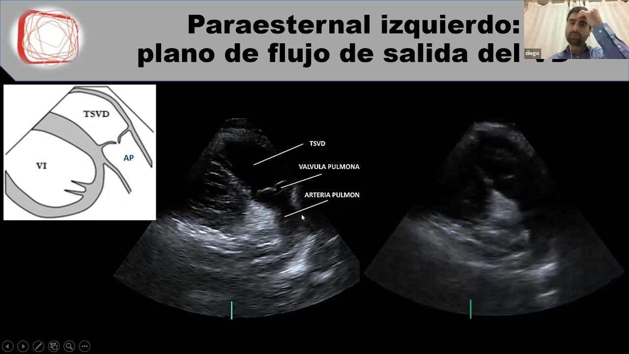 Clase 1. El ecocardiograma normal. Dr Freytes.