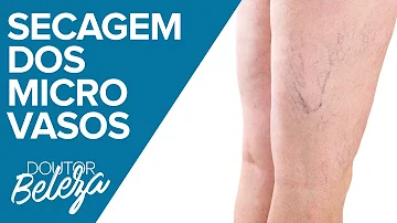 Quanto tempo demora para secar os vasinhos?
