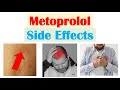 Metoprolol (&amp; Beta Blockers) Side Effects (&amp; Why They Occur)