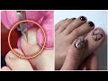 Most Satisfying Pedicure Transformation 😱 best nail polish for toes 2022