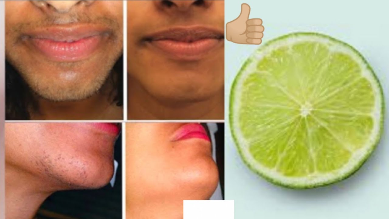 APPLY TO REMOVE UNWANTED HAIRS CHIN HAIR JAW HAIR HOW TO GET RID
