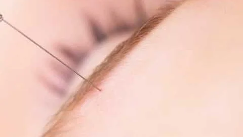 Good News - Auto Makers Pitch, Acupuncture Pain Re...