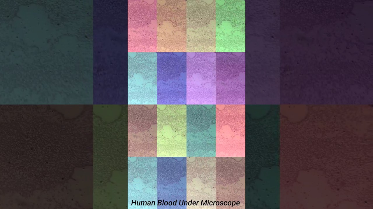 Human Blood Under microscope 🔬