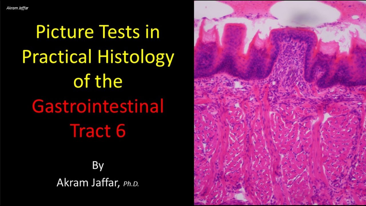 Picture Tests In Histology Of The Gastrointestinal System 2 Youtube Picture Tests In Histology Of The Gastrointestinal System 2 Youtube