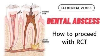 DENTAL ABSCESS - HOW TO PROCEED WITH RCT.