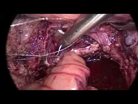 Onlaynda massajchi haqida porno film tomosha qiling. 3gp porno: mushukdagi sik