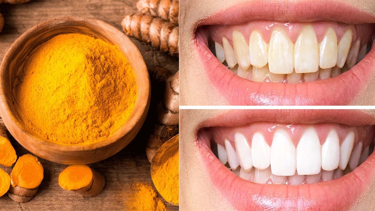Como se livrar dos dentes amarelados Receita natural de clareamento dos ...
