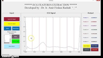 ECG_FE - GUI MAtlab