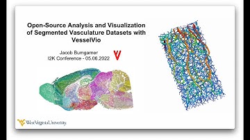 Jacob Bumgarner - VesselVio 2022 I2K Presentation